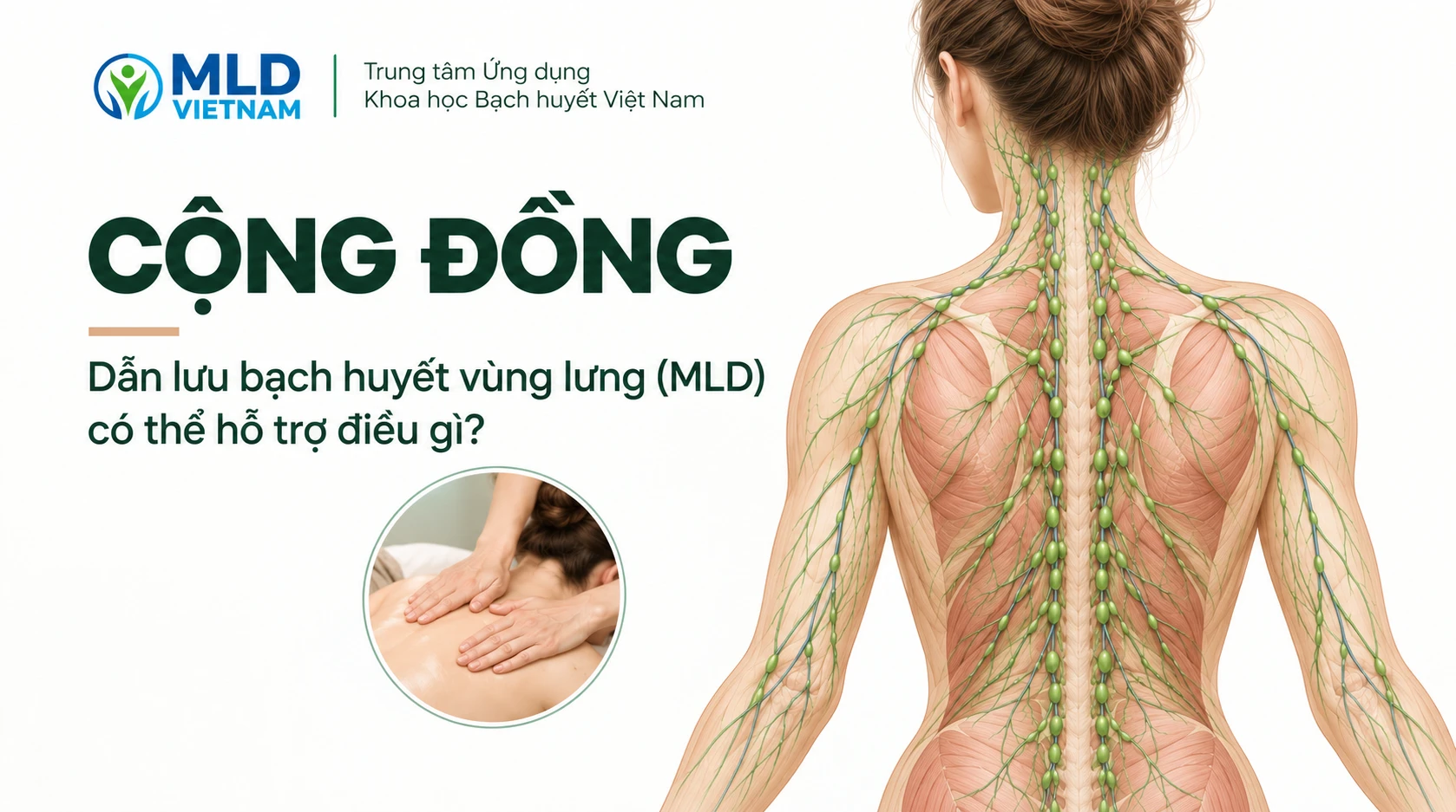 Dẫn lưu bạch huyết vùng lưng (MLD) có thể hỗ trợ điều gì?
